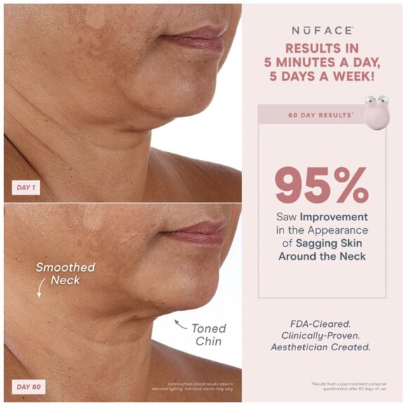 NIB Sealed NuFace Mini Facial Toning Device (gray) - Picture 2 of 7